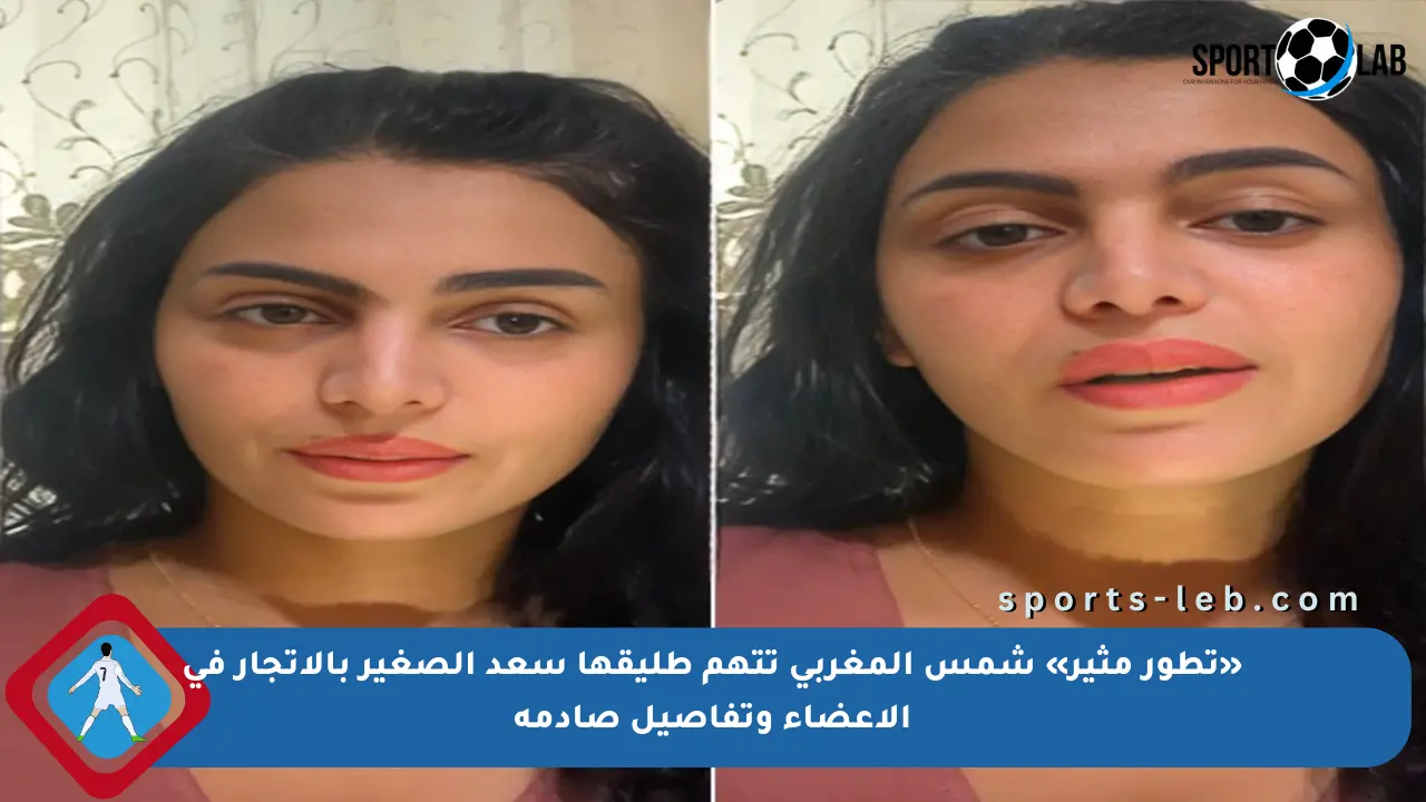 «تطور مثير» شمس المغربي تتهم طليقها سعد الصغير بالاتجار في الأعضاء وتفاصيل صادمة - sports-leb