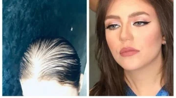 بعد مأساة رحمة حسن.. عكاظ ترصد فنانات سعوديات ضحايا عمليات التجميل