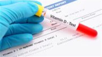 تفاصيل أسعار تحليل فيتامين D في المعامل الطبية وإجراءات الاستعداد