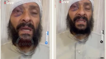 أصيب بنزيف مرتين.. فيديو يوثق سرقة أبناء الطبيب المصري بعد 30 عامًا سعودية