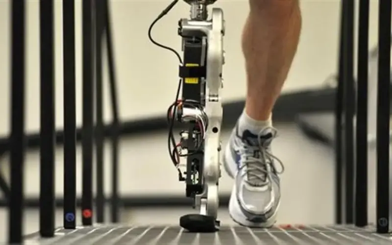 تكاليف الأطراف الصناعية في مصر 2026.. خيارات متعددة لذوي الهمم