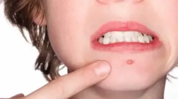 دليلك الكامل لاستخدام الثلج على الوجه.. المدة المسموحة والمخاطر المحتملة